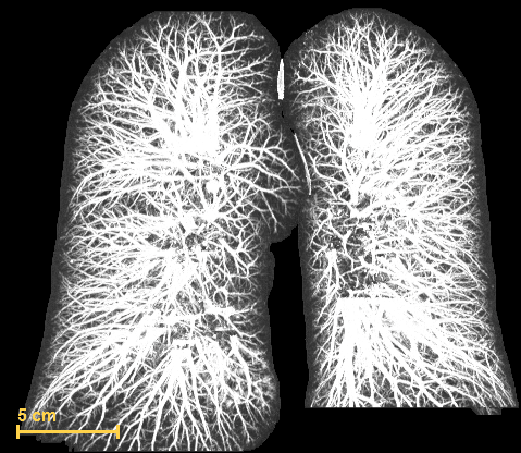 Pulmones en 3D girando